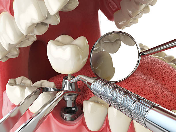 Best Emergency Denture Repair in La Grange, KY